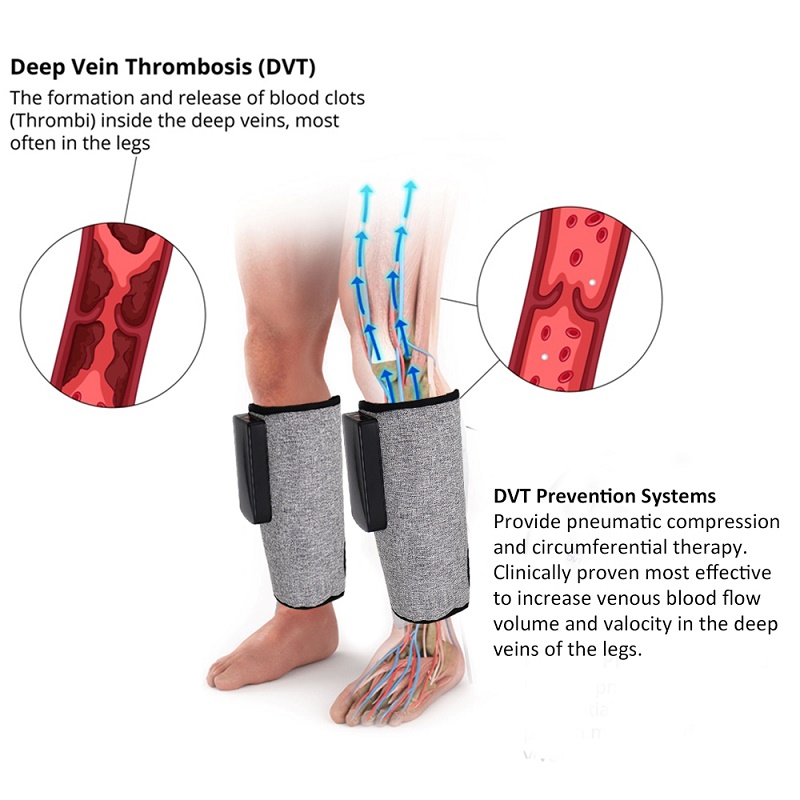 DVT prevention device