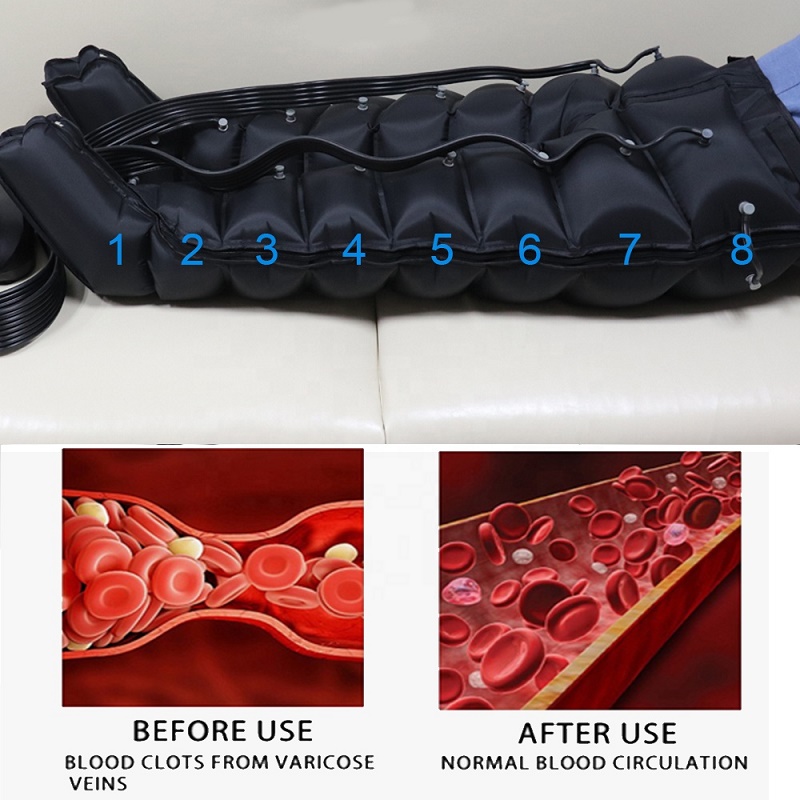 lymphedema treatment machine